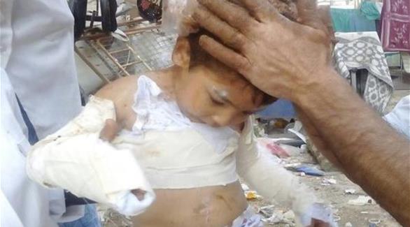 طفل أصيب بحروق جراء أنباء عن استخدام قوات النظام قذائف النابالم المحرمة دولياً (فيس بوك)