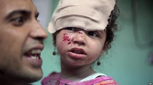 طفلة أصيبت في الغارات الإسرائيلية (أ ب)