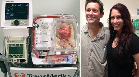 تقنية جديدة تتيح زراعة قلوب "ميتة" لإنقاذ مرضى القلب 201410240132208