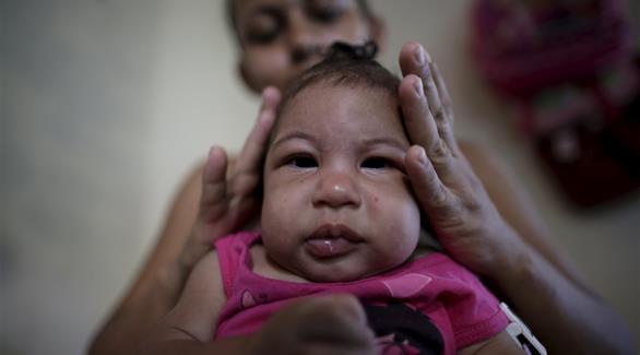 طفلة مولدة بصغر الرأس في أوليندا بعد إصابة والدتها أثناء الحمل بالفيروس (رويترز)