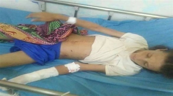 طفلة يمنية ضحية القصف الحوثي للضالع (نيوزيمن)