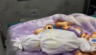 غزة: ارتفاع عدد الأطفال المتوفين بسبب سوء التغذية لـ 16