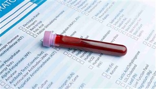 ثورة طبية.. اختبار دم يتنبأ بالسرطان قبل الإصابة بسنوات