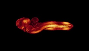 أول تصوير فعلي لبدايات تكوين الجنين