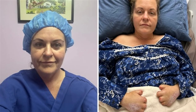 عملية تجميل تتحول لكابوس مرعب.. أم تخضع لـ 20 عملية بتر