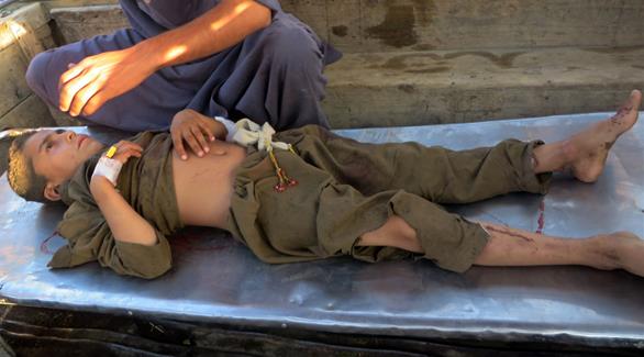 طفل مصاب جراء التفجير الإرهابي في باكستان (أ ف ب)