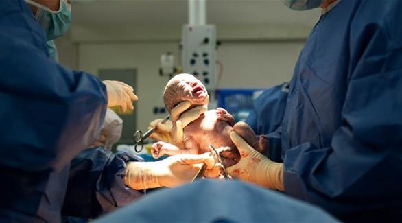 يتم التحول إلى الولادة القيصرية الطارئة في ربع حالات الولادة الطبيعية