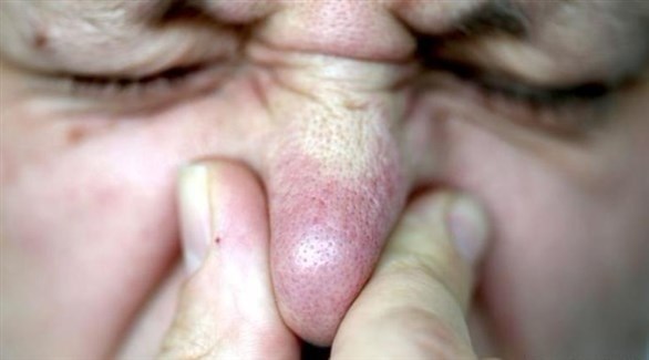 بريطاني أغلق أنفه وفمه أثناء العطس (أرشيف)