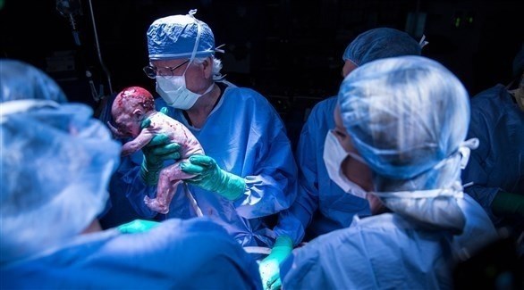 طبيب أمريكي يساهم في ولادة أول طفل من رحم مزروع (مستشفى بايلور)