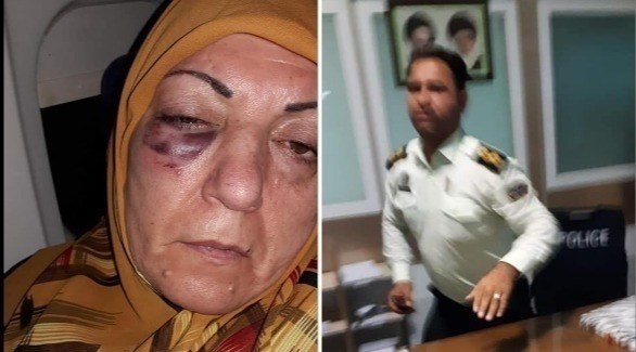 الضابط الإيراني المزعوم مع السيدة كما بدا وجهها مصاباً (تويتر)