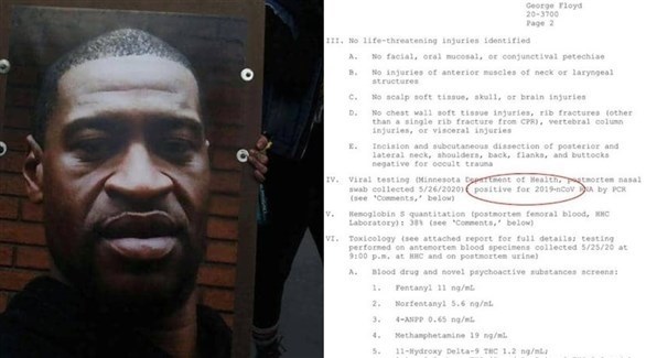 تقرير التشريح يثبت إصابة الأمريكي الأفريقي فلويد بكورونا عند وفاته (24)