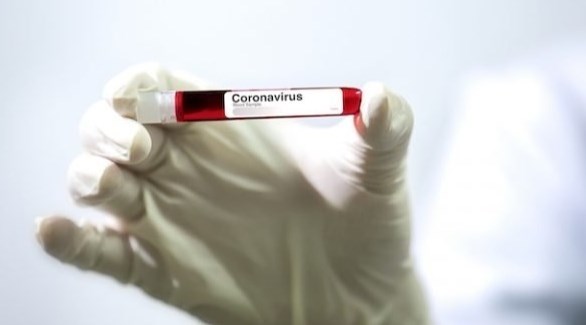 عينة دم لكشف فيروس كورونا (تعبيرية)