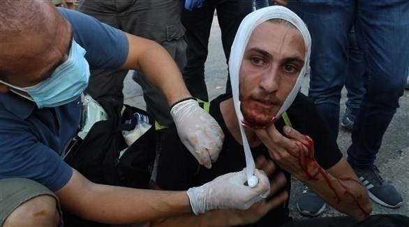 أحد الجرحى خلال الاشتباكات بين القوى الأمنية والمحتجين خلال تظاهرة بيروت (اي بي ايه)