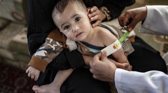 طفل يمني يعاني من سوء تغذية (أرشيف)