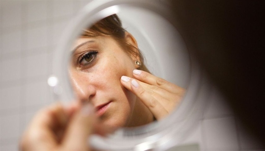 التهاب الجلد حول الفم يصيب النساء أكثر من الرجال (د ب أ)