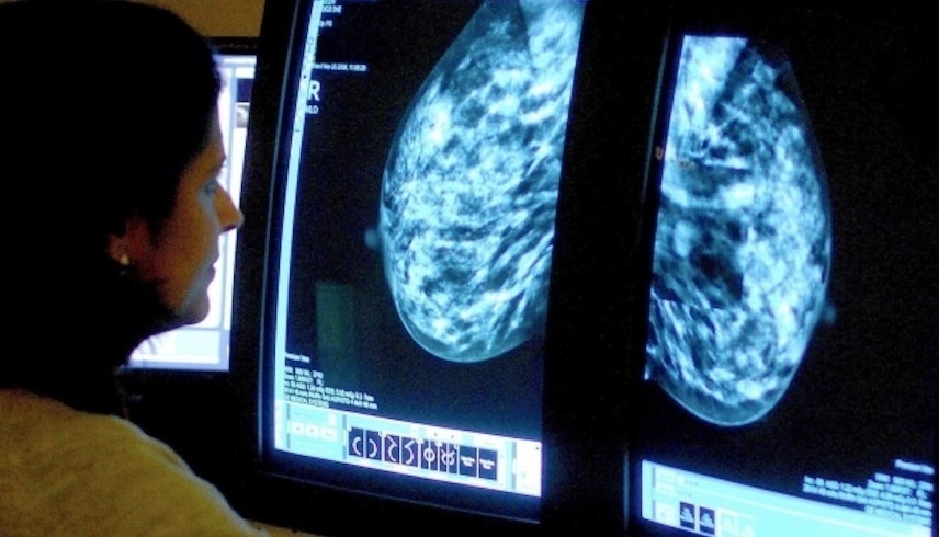 تتنبأ التقنية الجديدة بإمكانية انتشار سرطان الثدي في الجسم (ذا صن)