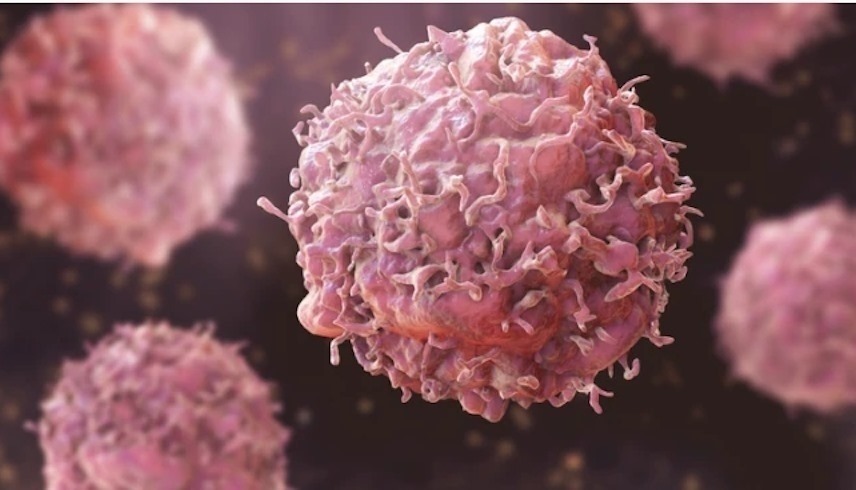اكتشاف بروتين مسؤول عن مقاومة السرطان من العلاج (ميترو)