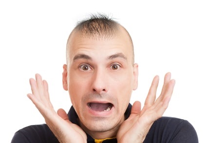 5 عوامل تؤدي إلى فشل زراعة الشعر